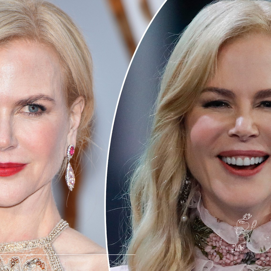 A leggyakoribb hibák botox kezelés során – amiket mi már csak korrigálunk - M2Med Blog