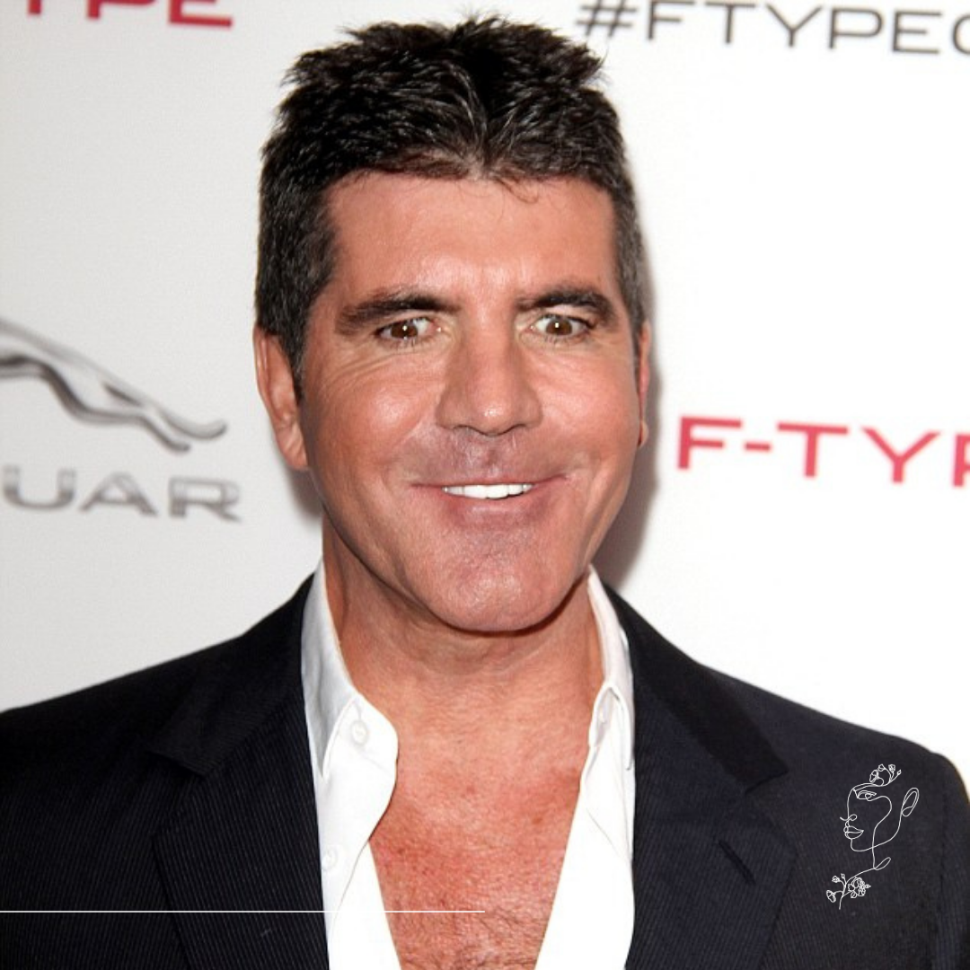 A leggyakoribb hibák botox kezelés során – amiket mi már csak korrigálunk - M2Med Blog