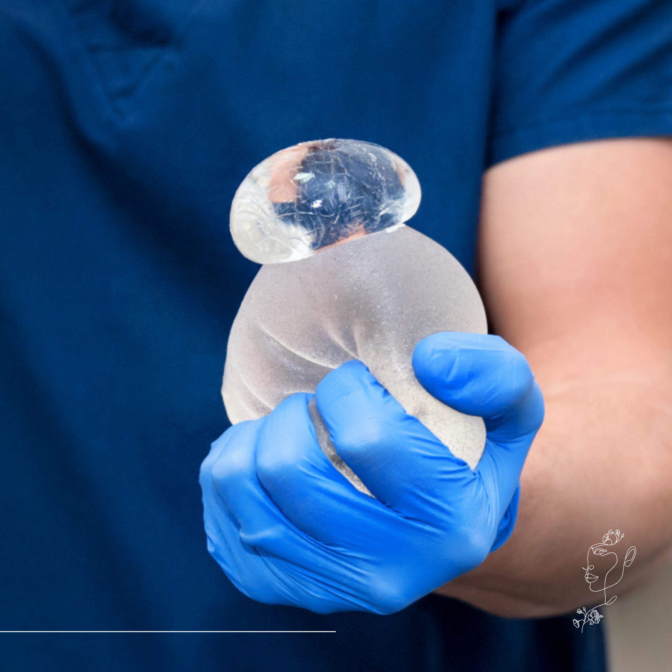 M2Med - Mellimplantátum ellenőrzése ultrahanggal – milyen problémák ismerhetők fel?
